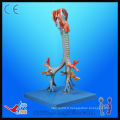 HR / A13006 CT Bronchial Tree with Larynx Model